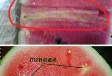 三通没有拧肝素帽 吃瓜,吃瓜群众热议医疗安全事件”